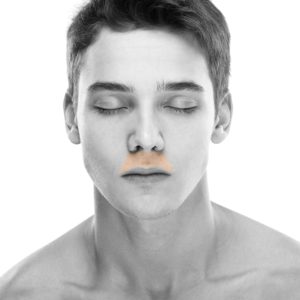 Men's Upper Lip Laser Hair Removal